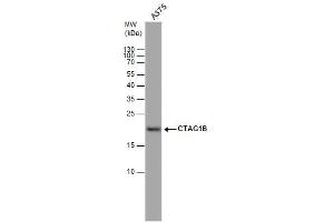 WB Image CTAG1B antibody detects CTAG1B protein by western blot analysis.