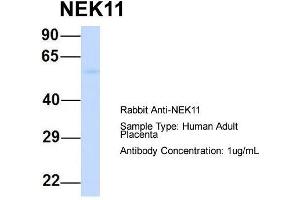 Image no. 5 for anti-NIMA (Never In Mitosis Gene A)-Related Kinase 11 (NEK11) (Middle Region) antibody (ABIN2783561)