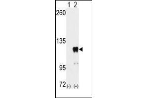 Image no. 3 for anti-Pumilio Homolog 2 (Drosophila) (PUM2) (Ser182) antibody (ABIN360017)