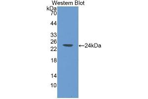 Image no. 1 for anti-Selectin P (Granule Membrane Protein 140kDa, Antigen CD62) (SELP) (AA 58-259) antibody (ABIN1078522)
