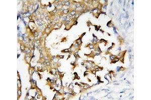 Image no. 1 for anti-Presenilin 2 (Alzheimer Disease 4) (PSEN2) (N-Term) antibody (ABIN3032302)