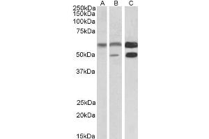 Image no. 2 for anti-Calcium/calmodulin-Dependent Protein Kinase II alpha (CAMK2A) (Internal Region) antibody (ABIN570984)