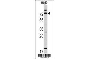Image no. 1 for anti-Calpain 9 (CAPN9) (AA 49-78), (N-Term) antibody (ABIN391477)