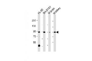 Image no. 3 for anti-Mitogen-Activated Protein Kinase Kinase Kinase 12 (MAP3K12) (AA 828-859), (C-Term) antibody (ABIN391319)