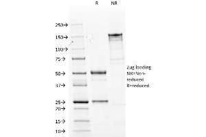 Image no. 1 for anti-Keratin 14 (KRT14) (C-Term) antibody (ABIN6939906)
