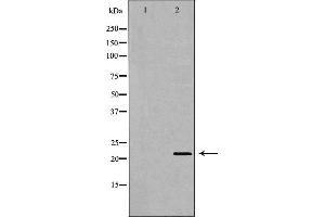 Image no. 2 for anti-Nudix (Nucleoside Diphosphate Linked Moiety X)-Type Motif 1 (NUDT1) (Internal Region) antibody (ABIN6263763)