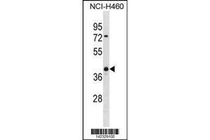 Image no. 1 for anti-Ubiquitin Carboxyl-terminal Hydrolase L5 (UCHL5) (AA 136-164) antibody (ABIN1881974)