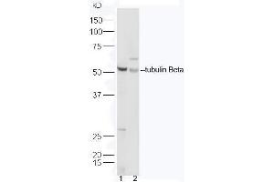 Image no. 4 for anti-Tubulin, beta (TUBB) (AA 61-160) antibody (ABIN706721)