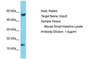 Image no. 1 for anti-Actin Related Protein 2/3 Complex, Subunit 5, 16kDa (ARPC5) (N-Term) antibody (ABIN6750511)