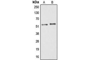 Western blot analysis of ARMC6 expression in HT29 (A), COLO205 (B) whole cell lysates.