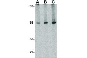 Image no. 1 for anti-Cytokine Receptor-Like Factor 2 (CRLF2) (Internal Region) antibody (ABIN6655338)
