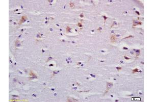Image no. 1 for anti-Bardet-Biedl Syndrome 9 (BBS9) (AA 244-320) antibody (ABIN1387812)