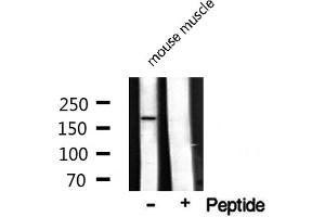 Image no. 2 for anti-Topoisomerase (DNA) II alpha 170kDa (TOP2A) (Internal Region) antibody (ABIN6265673)