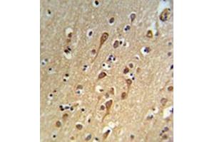 Image no. 1 for anti-Upregulator of Cell Proliferation (URGCP) (AA 473-503), (Middle Region) antibody (ABIN955472)