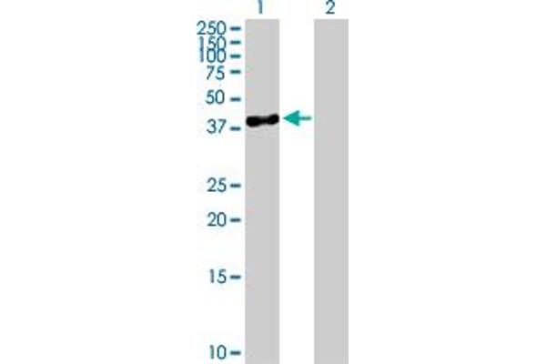 SERPINB10 Antikörper  (AA 1-397)