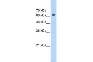 Image no. 1 for anti-BTB (POZ) Domain Containing 14A (BTBD14A) antibody (ABIN2461008)