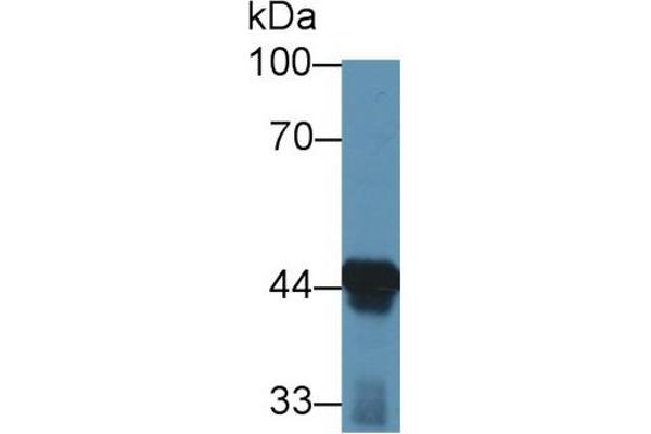 anti-Acetyl-CoA Acyltransferase 1 (ACAA1) (AA 182-424) antibody