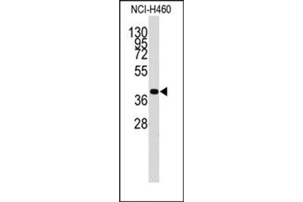 LECT1 antibody  (C-Term)