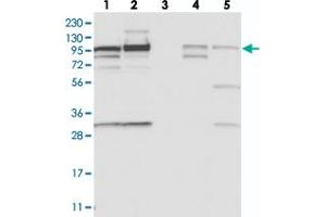 Image no. 2 for anti-Scavenger Receptor Class F, Member 2 (SCARF2) antibody (ABIN5587464)