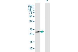 Western Blot analysis of PDE4DIP expression in transfected 293T cell line by PDE4DIP MaxPab polyclonal antibody.