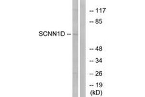 Image no. 1 for anti-Sodium Channel, Nonvoltage-Gated 1, delta (SCNN1D) (AA 411-460) antibody (ABIN1534625)