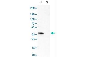Image no. 2 for anti-SIX Homeobox 1 (SIX1) antibody (ABIN5650219)