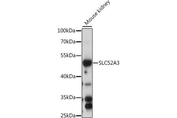 Solute Carrier Family 52 (Riboflavin Transporter), Member 3 (SLC52A3) (AA 200-300) antibody