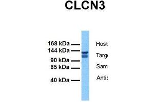 Image no. 5 for anti-Chloride Channel 3 (CLCN3) (C-Term) antibody (ABIN2776327)
