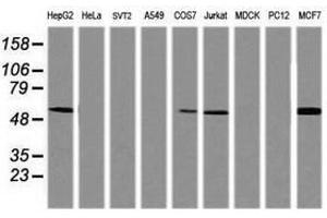 Image no. 2 for anti-TAP Binding Protein-Like (TAPBPL) antibody (ABIN1501300)
