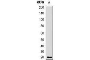 Image no. 2 for anti-CKLF-Like MARVEL Transmembrane Domain Containing 8 (CMTM8) antibody (ABIN2957533)