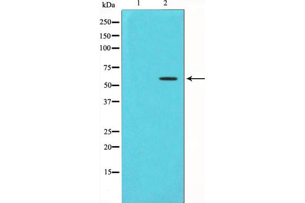 CHEK1 anticorps  (pSer280)