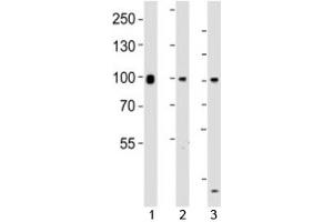 Image no. 2 for anti-SUZ12 Polycomb Repressive Complex 2 Subunit (SUZ12) (AA 496-530) antibody (ABIN3029057)