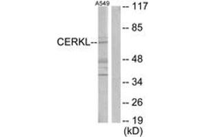 Image no. 1 for anti-Ceramide Kinase-Like (CERKL) (AA 341-390) antibody (ABIN1533943)