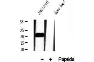 Image no. 2 for anti-Transgelin 2 (TAGLN2) (Internal Region) antibody (ABIN6265713)