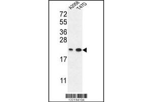 anti-Abhydrolase Domain Containing 14B (ABHD14B) (C-Term) antibody