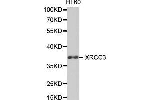 Image no. 2 for anti-X-Ray Repair Complementing Defective Repair in Chinese Hamster Cells 3 (XRCC3) antibody (ABIN3023006)