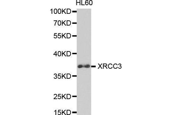 XRCC3 antibody  (AA 62-346)