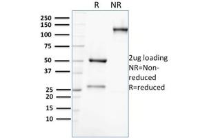 Image no. 5 for anti-Aldo-keto Reductase Family 1, Member C2 (AKR1C2) antibody (ABIN6939232)