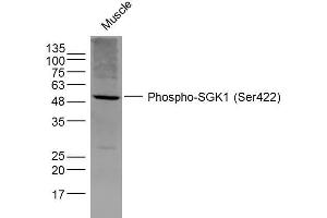 Image no. 3 for anti-serum/glucocorticoid Regulated Kinase 1 (SGK1) (pSer422) antibody (ABIN745703)