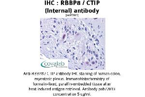 Image no. 2 for anti-Retinoblastoma Binding Protein 8 (RBBP8) (Internal Region) antibody (ABIN1738768)