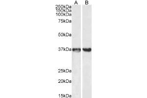 Image no. 7 for anti-Glyceraldehyde-3-Phosphate Dehydrogenase (GAPDH) (C-Term) antibody (ABIN185240)