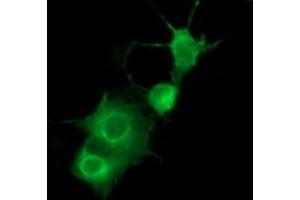 Image no. 3 for anti-Platelet Derived Growth Factor Receptor beta (PDGFRB) antibody (ABIN1500102)