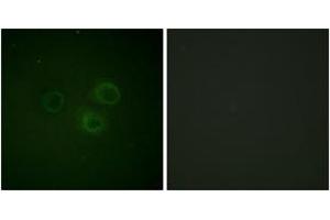 Image no. 3 for anti-CD226 (CD226) (AA 287-336), (pSer329) antibody (ABIN1531541)