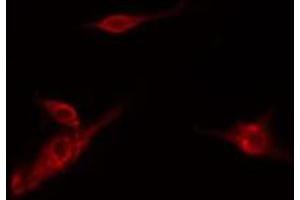 Image no. 1 for anti-Hexokinase 3 (White Cell) (HK3) (Internal Region) antibody (ABIN6262225)