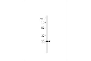 DLX6 antibody  (C-Term)