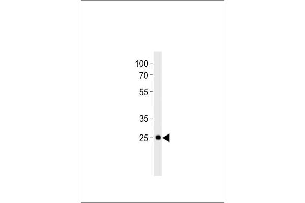 DLX6 anticorps  (C-Term)