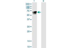Image no. 1 for anti-Growth Factor Receptor-Bound Protein 7 (GRB7) (AA 37-136) antibody (ABIN516181)