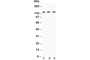 Image no. 3 for anti-Hypoxia Inducible Factor 1, alpha Subunit (Basic Helix-Loop-Helix Transcription Factor) (HIF1A) (AA 703-732) antibody (ABIN3028724)
