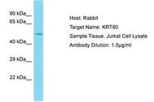Image no. 1 for anti-Keratin 80 (KRT80) (AA 57-106) antibody (ABIN6750577)