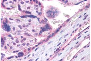 Image no. 2 for anti-V-Maf Musculoaponeurotic Fibrosarcoma Oncogene Homolog (Avian) (MAF) (N-Term) antibody (ABIN6745717)